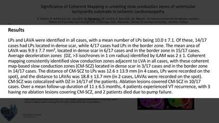 Significance of Coherent Mapping in unveiling slow conduction zones of ventricular tachycardia substrate in ischemic cardiomyopathy