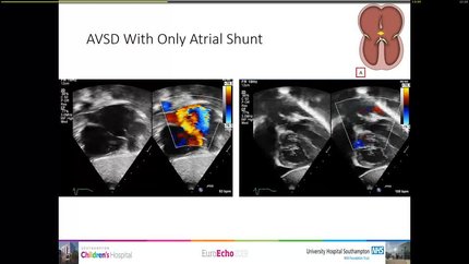 Presentation thumbnail