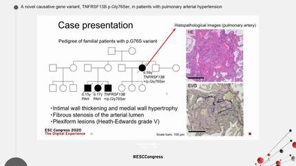 Presentation thumbnail