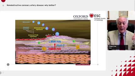 Nonobstructive coronary artery disease: why bother?