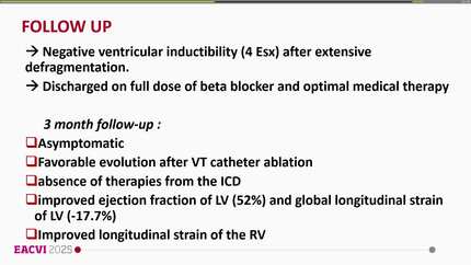 Cardiac CT substrate-guided RF-ablation of VT-storm in systemic scleroderma