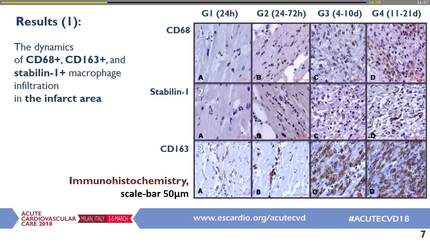 Cardiac macrophages in wound healing following myocardial infarction: from experiment to clinic 