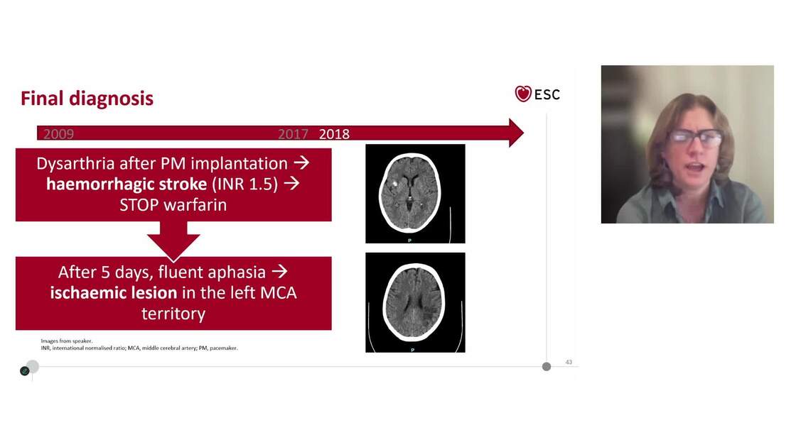Esc 365 Multimodality Imaging In Cardiomyopathies