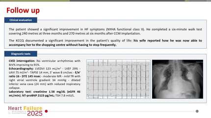 Regaining the ability to keep up with your wife at the shopping centre: the impact of a cardiac contractility modulation device in advanced heart failure.