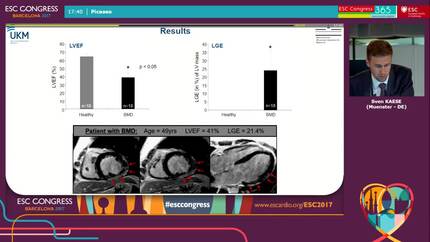 Relation between serum values of angiopoietin-2 and vascular endothelial growth factor with the degree of cardiomyopathy and skeletal myopathy in patients with muscular dystrophy