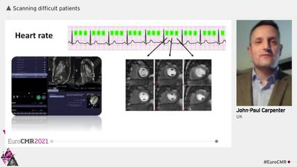 Scanning difficult patients 