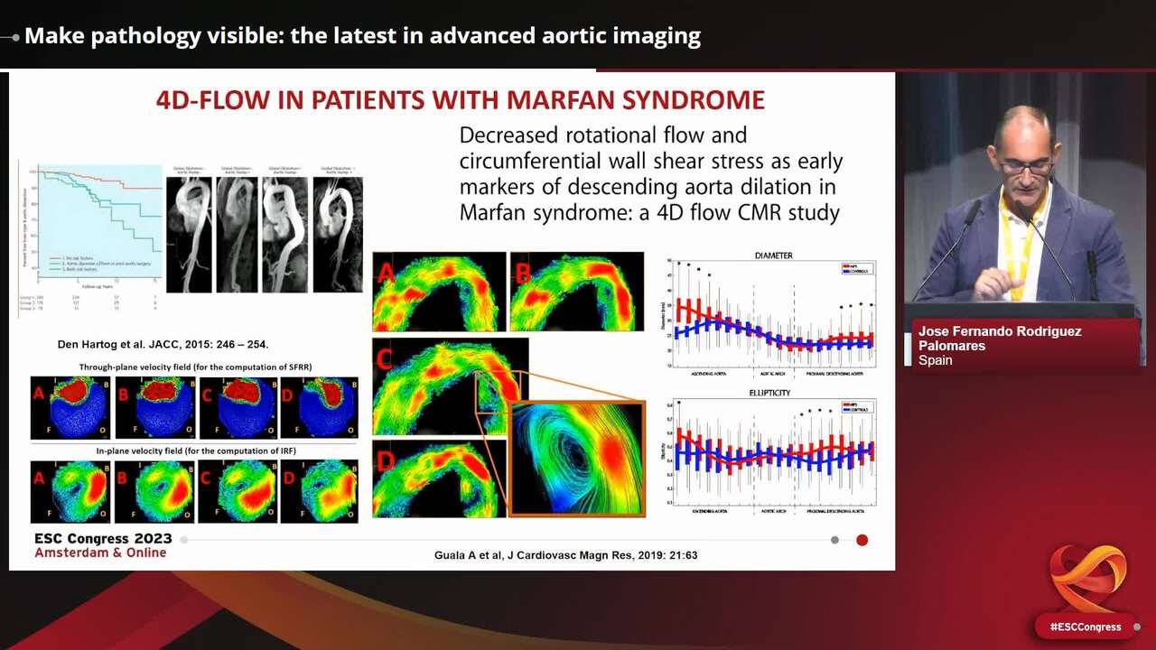 Make pathology visible: the latest in advanced aortic imaging