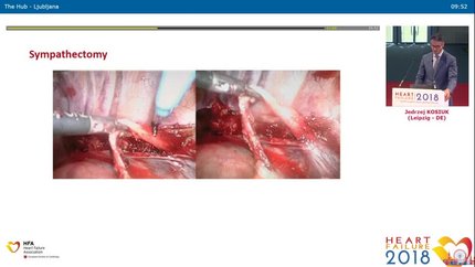 Presentation thumbnail