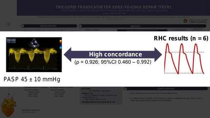 Tricuspid transcatheter edge-to-edge repair (TEER): right ventricle (RV) function and RV-pulmonary artery (RV-PA) coupling characterization in a real-world setting