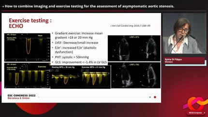 How to combine imaging and exercise testing for the assessment of asymptomatic valvular heart disease