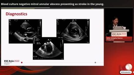 Blood culture negative mitral annular abscess presenting as stroke in the young.