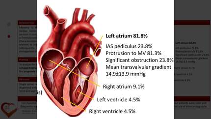Cardiac myxoma: experience of the last 12 years