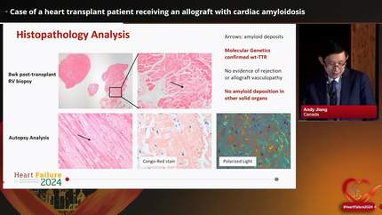 Case of a heart transplant patient receiving an allograft with cardiac amyloidosis