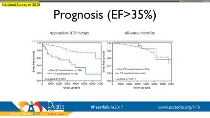When to implant ICD in rare cardiomyopathies.
