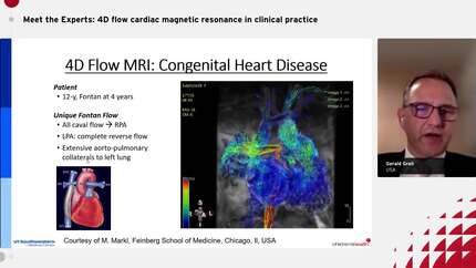 Meet the Experts: 4D flow cardiac magnetic resonance in clinical practice