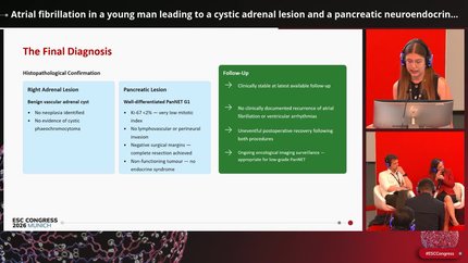 Arrhythmias in systemic and structural disease
