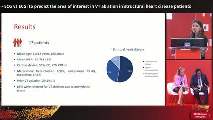 ECG vs ECGi to predict the area of interest in VT ablation in structural heart disease patients