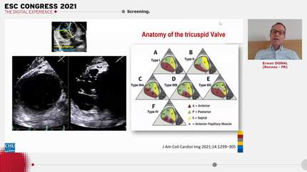 Presentation thumbnail