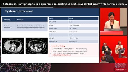 Cardiac manifestations of systemic disorders