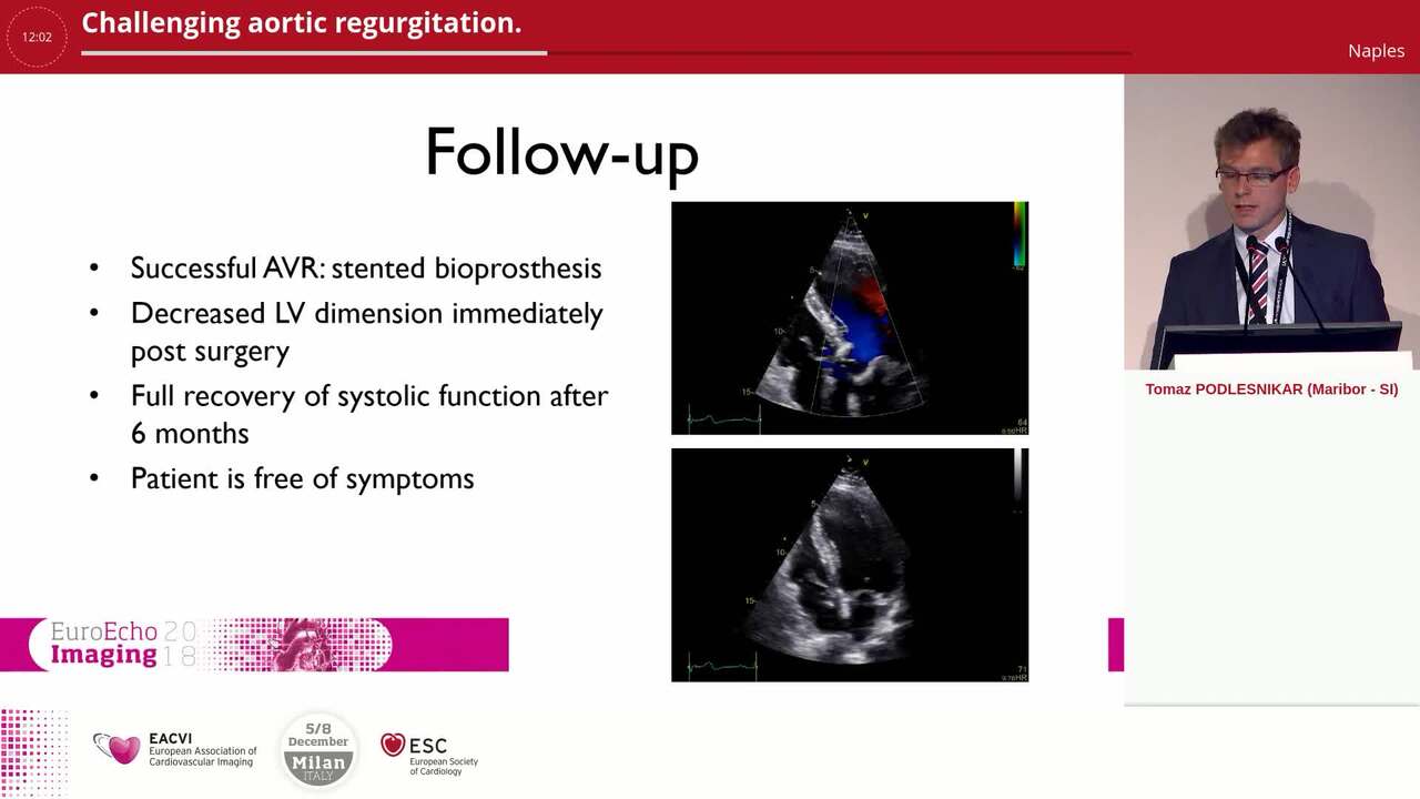 Challenging aortic regurgitation.