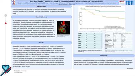 Post-myocarditis VT ablation: CT-based 3D scar characterization and association with clinical outcomes