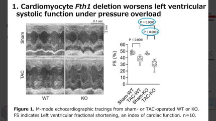 Reduced Ferritin heavy chain expression in cardiomyocytes induces ferroptosis-independent cardiac dysfunction in pressure-overloaded mouse hearts 