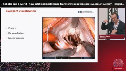 How artificial intelligence enhanced application translates cardiovascular routine - insights from Germany and Switzerland