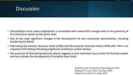 Post-TAVI QRS alternans: What is the mechanism?