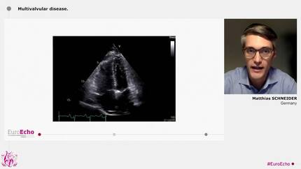 Presentation thumbnail