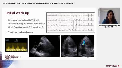 Presenting late: ventricular septal rupture after myocardial infarction.