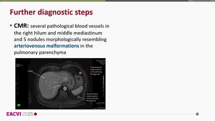 Presentation thumbnail