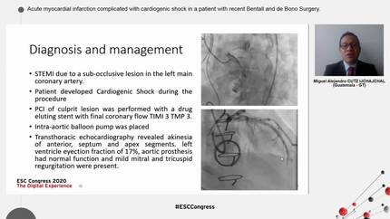 Acute myocardial infarction complicated with cardiogenic shock in a patient with recent Bentall and de Bono Surgery.