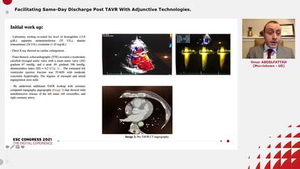Facilitating Same-Day Discharge Post TAVR With Adjunctive Technologies.