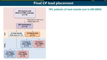 A roadmap for LV lead placement in CRT: integration of ECG imaging, coronary venous CT, and delayed enhancement CMR 