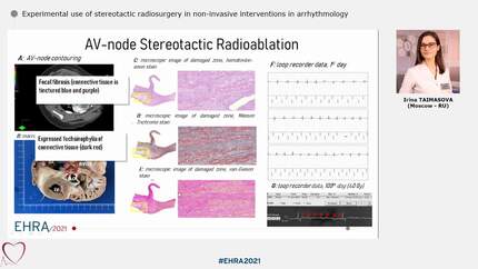 Experimental use of stereotactic radiosurgery in non-invasive interventions in arrhythmology