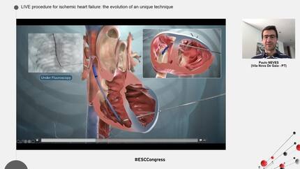 Presentation thumbnail