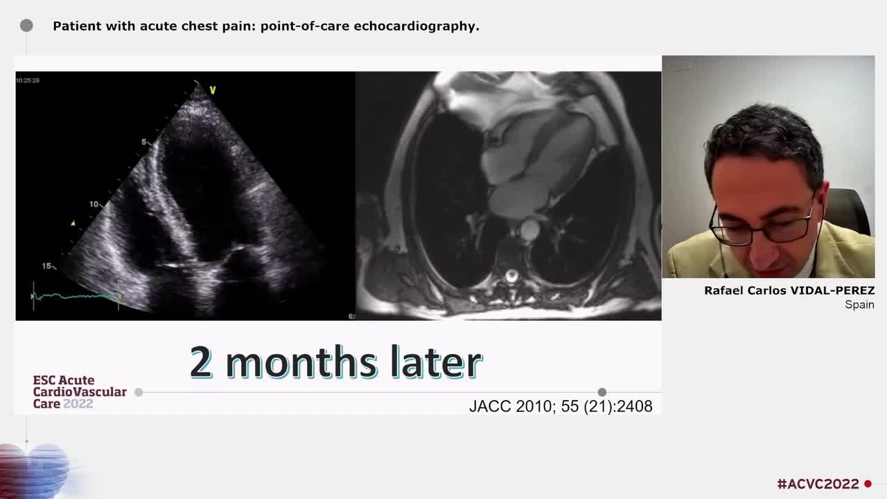 Techniques in acute cardiovascular care 'Live-in-the-Box'