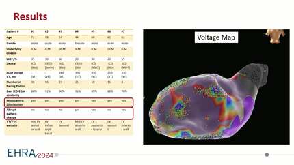 Neural network for automatic ICD-EGMs matching in pace-mapping and ablation of ventricular arrhythmias.