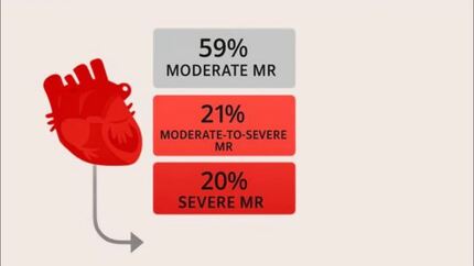 Presentation thumbnail