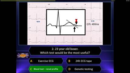 Sports cardiology ECG Quiz: The Master of Sports Cardiology
