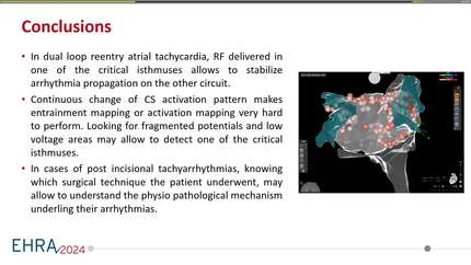 Continuous activation changes in dual loop left atrial tachycardia
