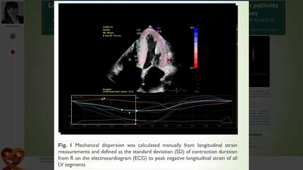 Left ventricular speckle-tracking-derived mechanical dispersion in patients with transthyretin amyloidosis and their first-degree relatives