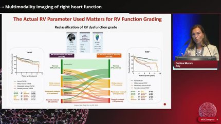 Right ventricular function: getting it right?