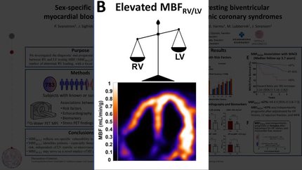 Sex-specific diagnostic and prognostic value of a resting biventricular myocardial blood flow ratio measured by PET in chronic coronary syndromes