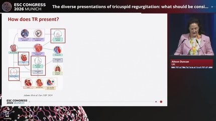 Current evidence on the management of mitral and tricuspid regurgitation in heart failure