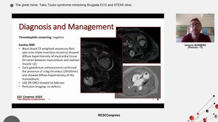 Presentation thumbnail