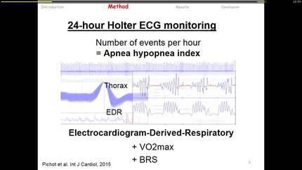 Impact of cardiac rehabilitation on the obstructive sleep apnoea  in the coronary artery disease