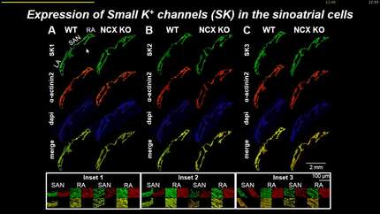 Contribution of small conductance K+ channels to sinoatrial node pacemaker activity of control and atrial-specific Na+/Ca2+ exchange knock out mice.