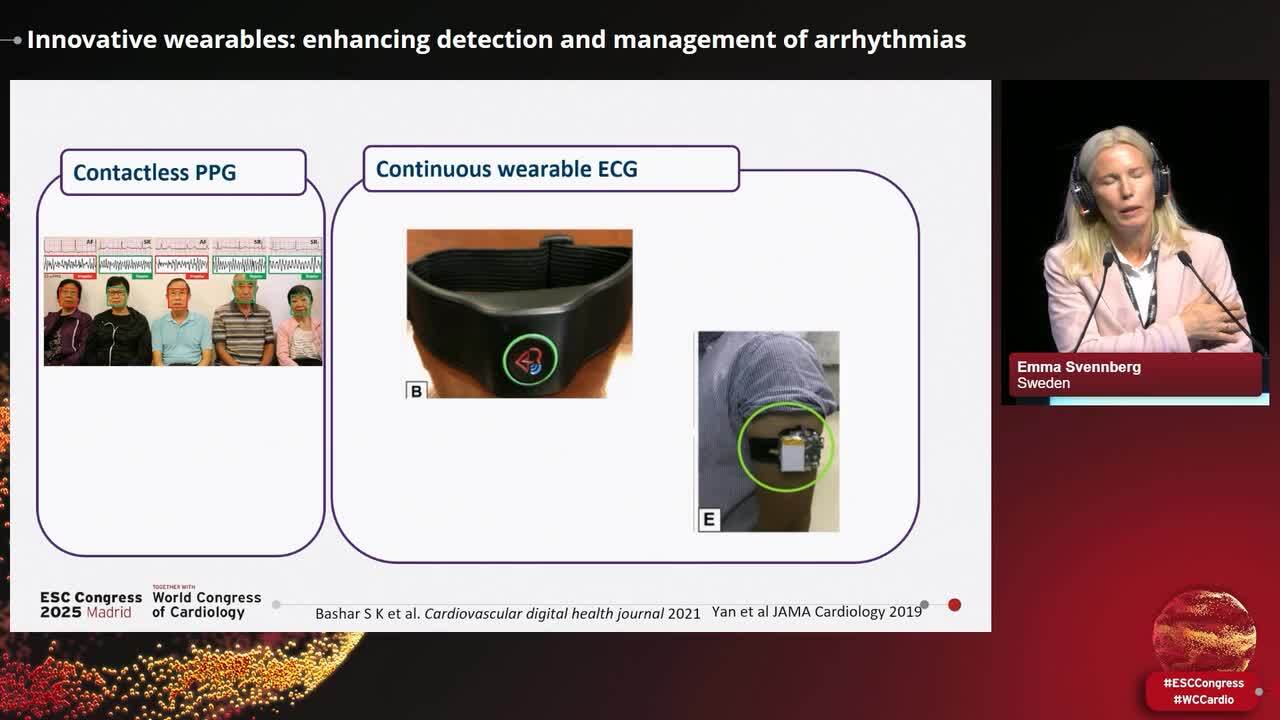 How wearables are transforming remote monitoring of cardiovascular diseases