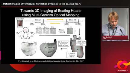 Optical imaging of ventricular fibrillation dynamics in the beating heart.